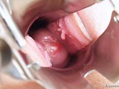Juicy Nurse Ruth Muff Spread And Medical Instruments Insertion